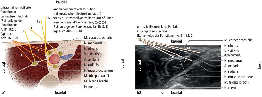 axiläärer Plexus 2